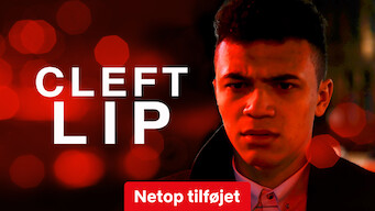 Cleft Lip